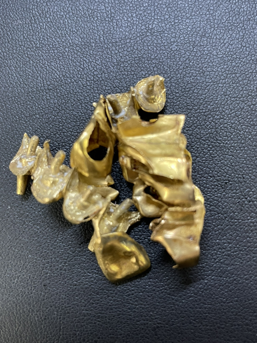 金歯もお買取り致します！